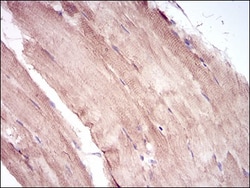 MuRF1/TRIM63 Antibody (6H6D4) - BSA Free, Novus Biologicals:Antibodies:Primary